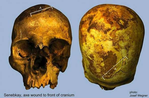El cráneo de Senebkay presenta varias heridas profundas realizadas con hachas de guerra.