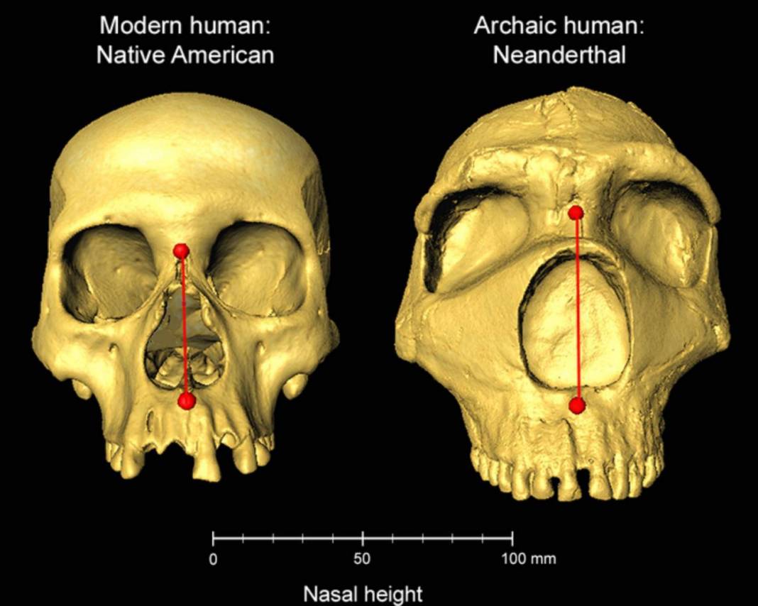 Gen neandertal puede cambiar la altura nasal humana.