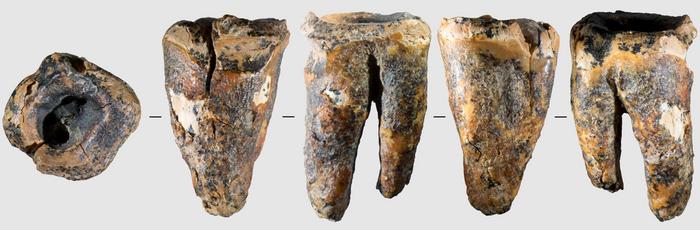 Descubren vestigios de un procedimiento odontológico en diente neandertal.